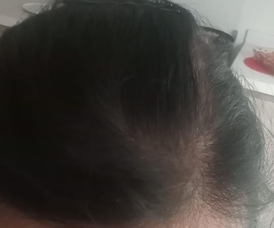 Despues