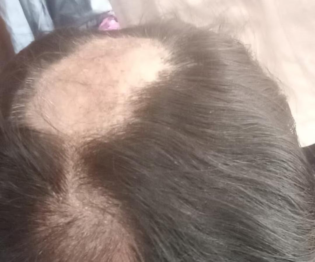 Antes